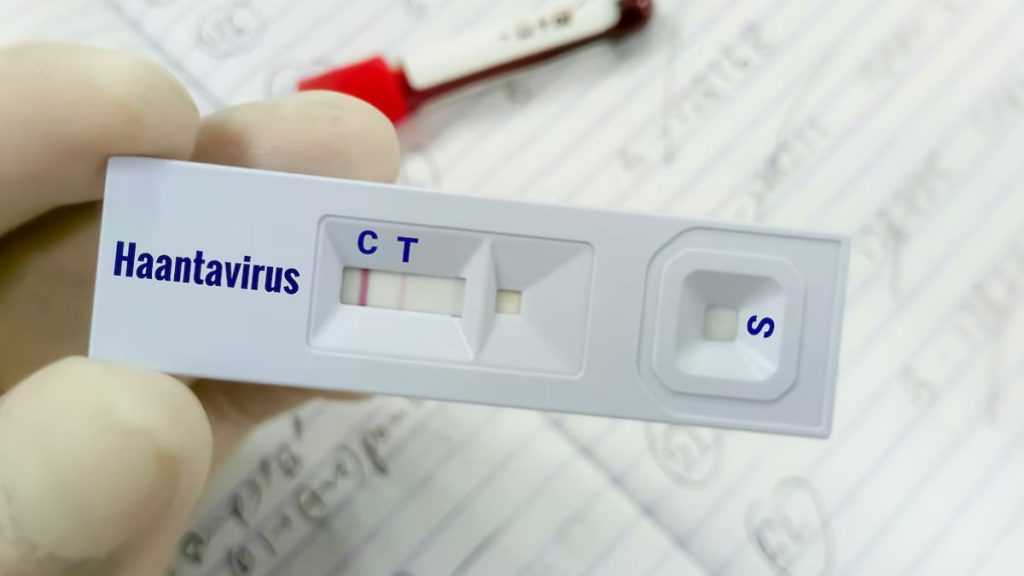 Síntomas de Hantavirus