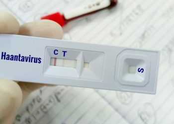Gloved hand holding a rapid test card labeled Haantavirus; test window shows a single line at C (control) and no line at T (negative result).