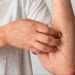 Person in a white shirt rubs or scratches their forearm, which has red, bumpy rash patches on the skin.